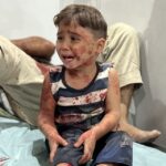 gazzede 15 binden fazla hasta yardim bekliyor 5ZMQDKFs