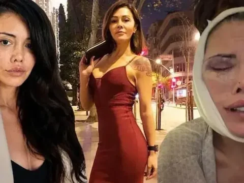 Yuz nakli yaptiran didem ceran gozyaslariyla anlatti beni sikayet ediyorlar VK57yZsE